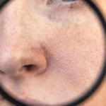 Dernathology Uncover Behind: How Long Does It Take for Your Pores to Close After a Shower